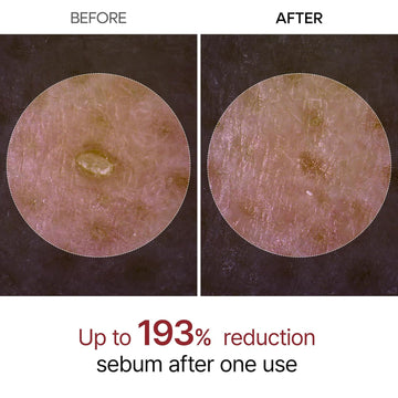 Achieve Radiant Skin Instantly